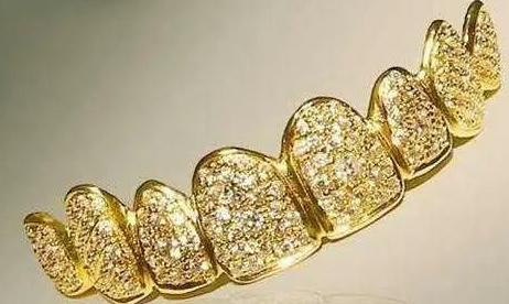 牙齿黄金效果怎么样（牙齿黄金有用吗）